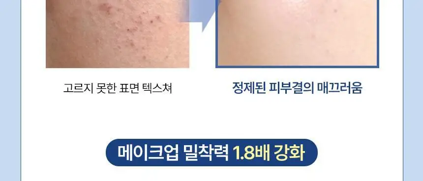 [속광화잘먹] 샤이샤이샤이 리포좀 리페어 밀키 크림 50ml 상세페이지 32